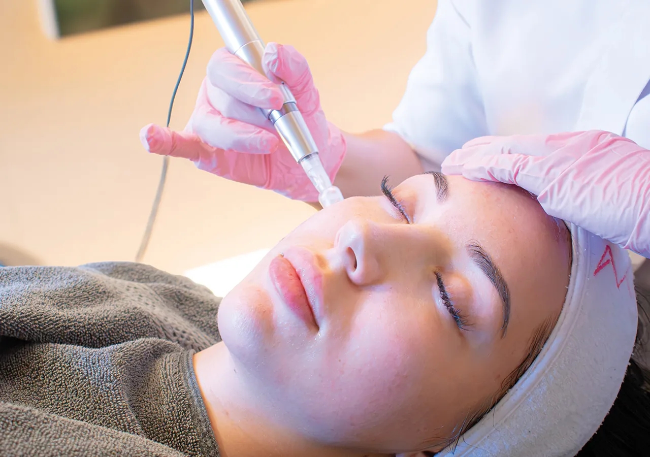 Kosmetikerin führt das Microneedling-Gerät über die Wange einer Kundin